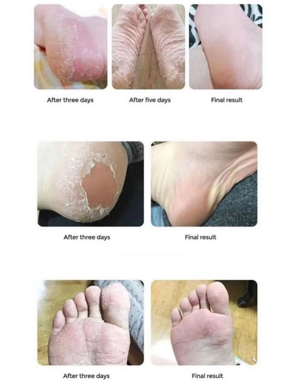 اسپری پا برند راکو  Rako foot exfoliator