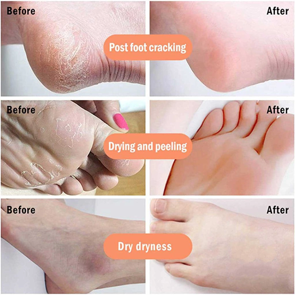 اسپری پا برند راکو  Rako foot exfoliator