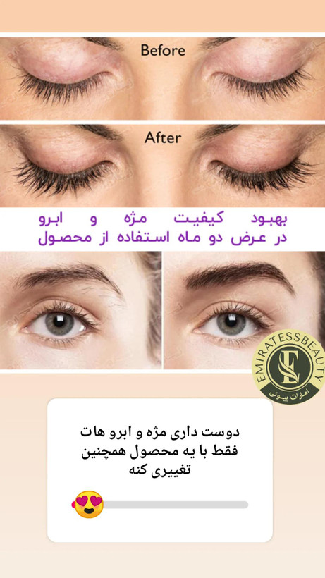 سرم تقویت کننده مژه و ابرو بیوکسین اصلی و تضمینی